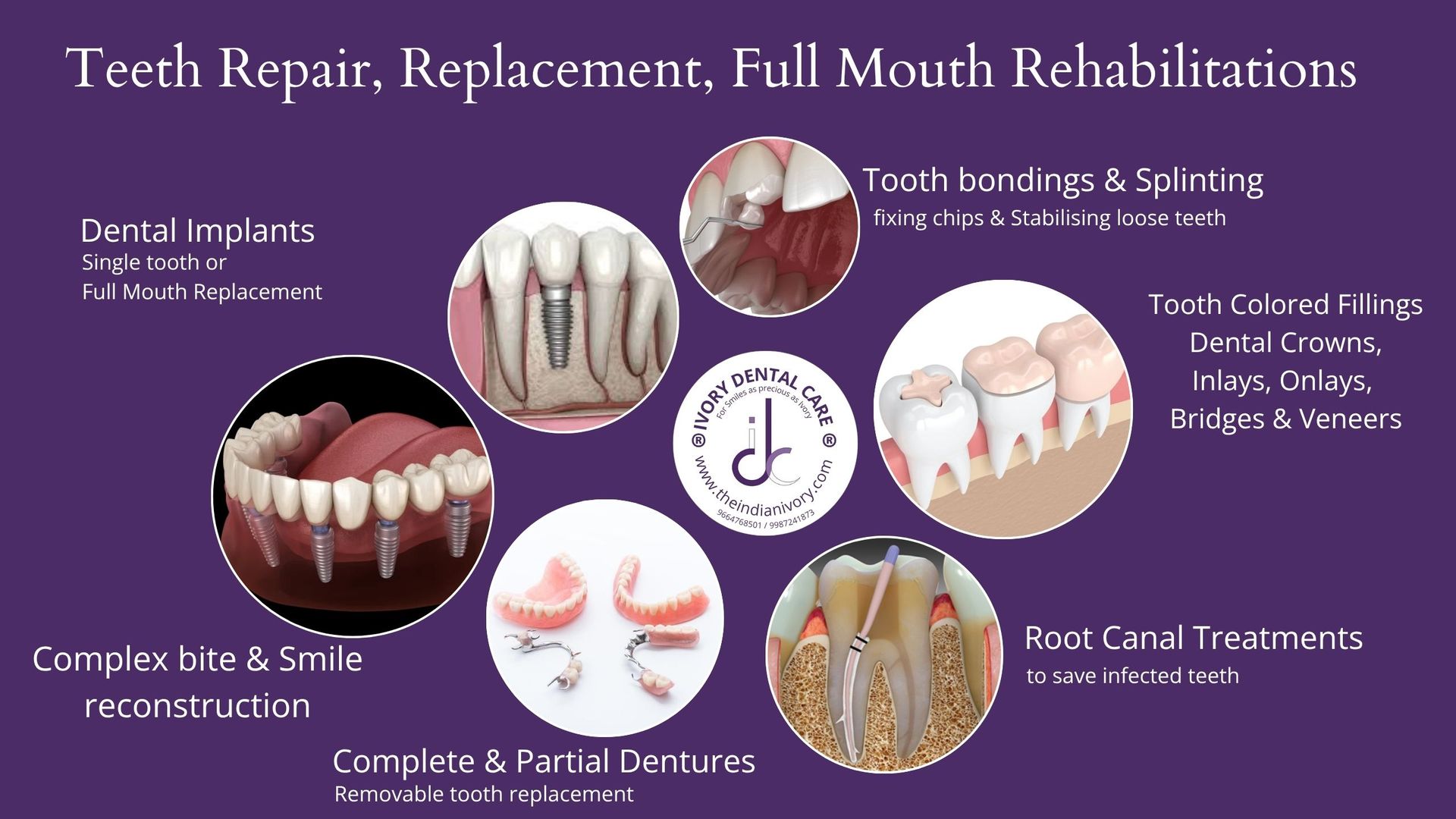 dental implants in yari road andheri west
