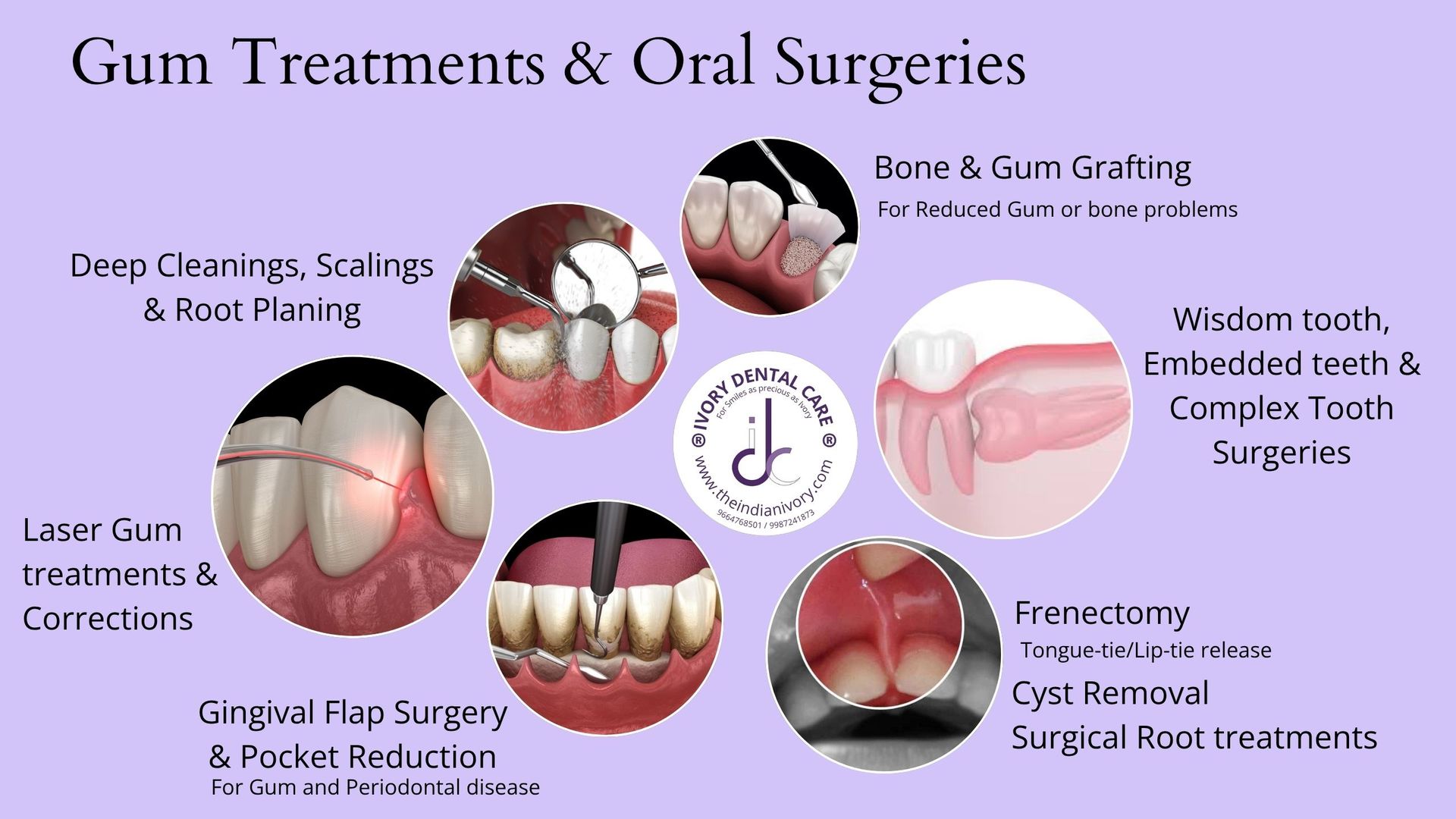 wisdom tooth surgery doctor in yari road