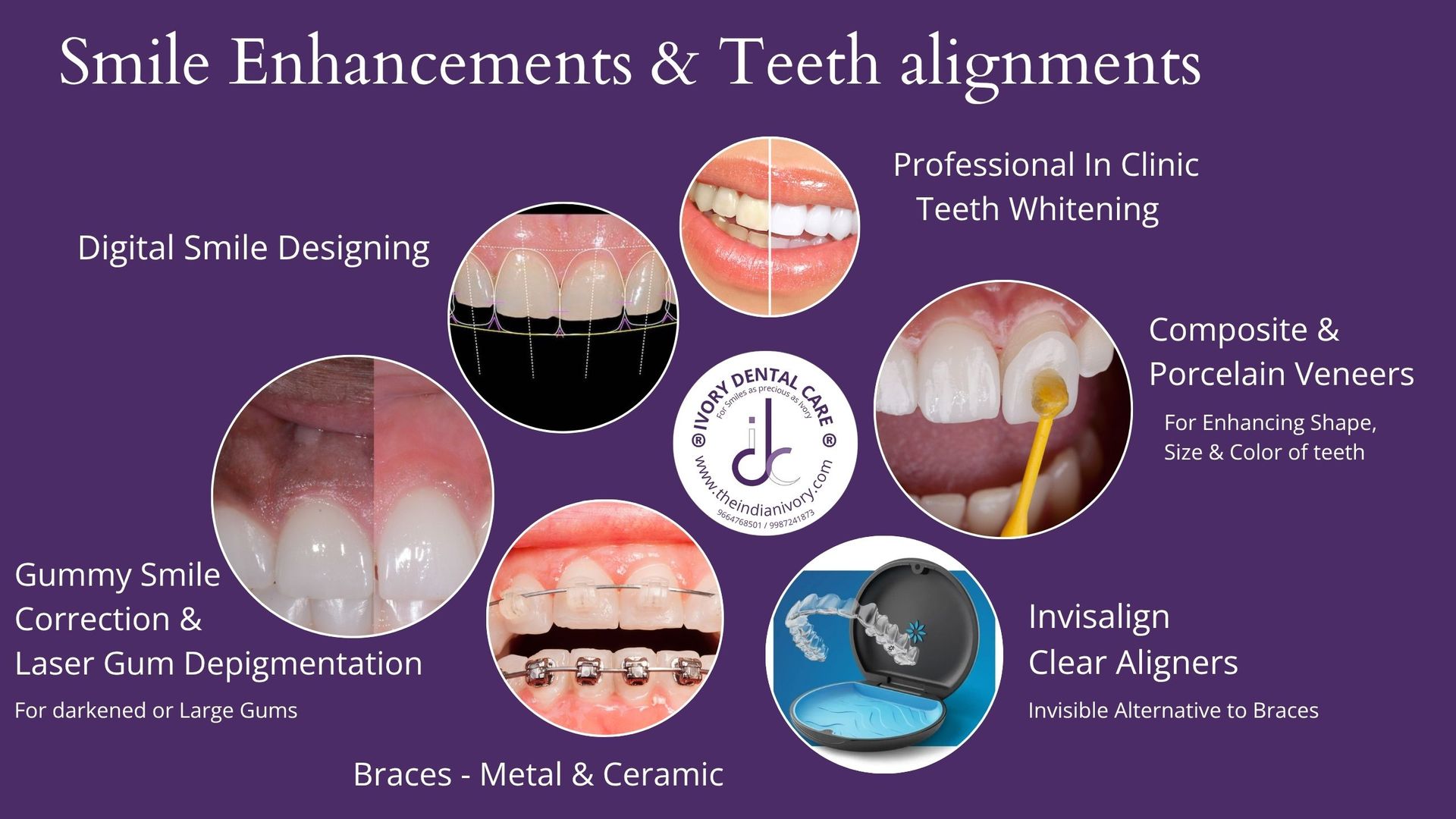 teeth whitening in yari road best dentist in yari road