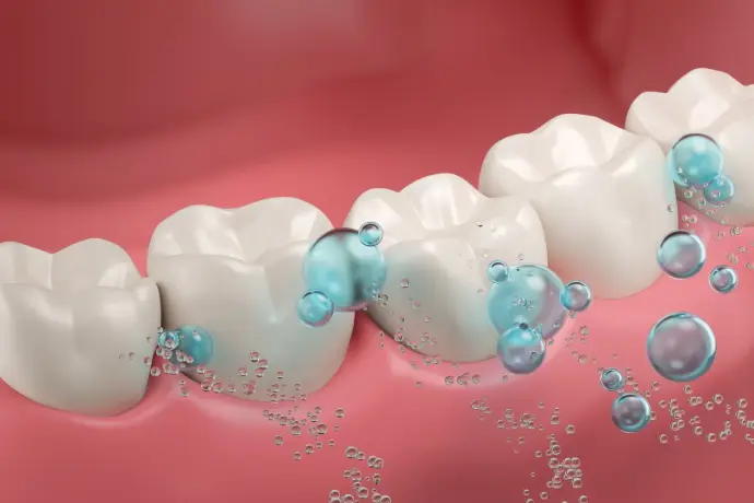teeth fluoride application